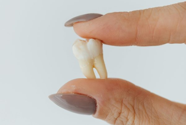 woman holding an extracted tooth