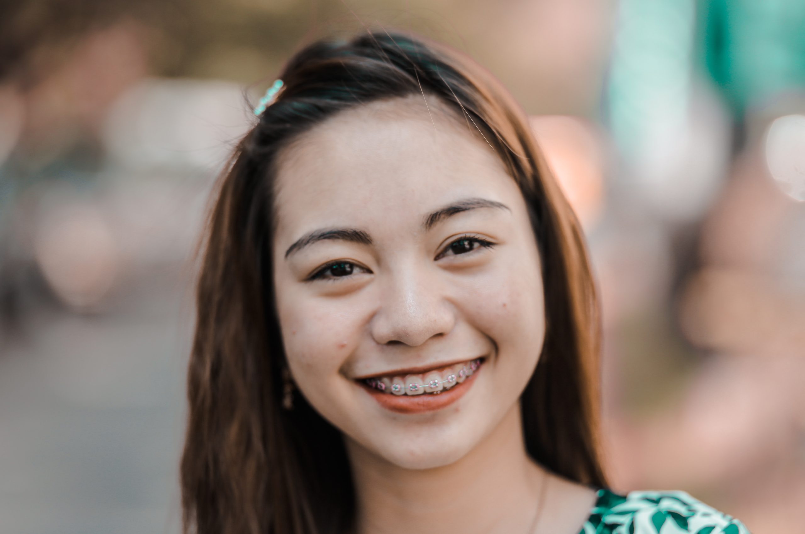 A complete guide to braces treatment in Singapore