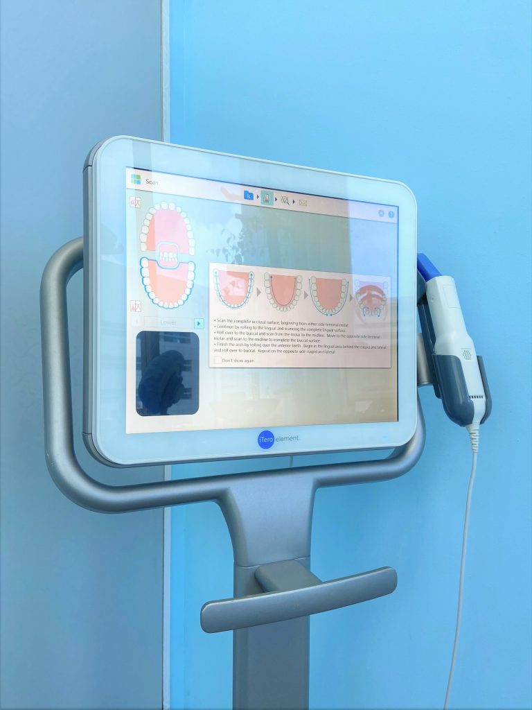 itero scanner (3D didital scanner)