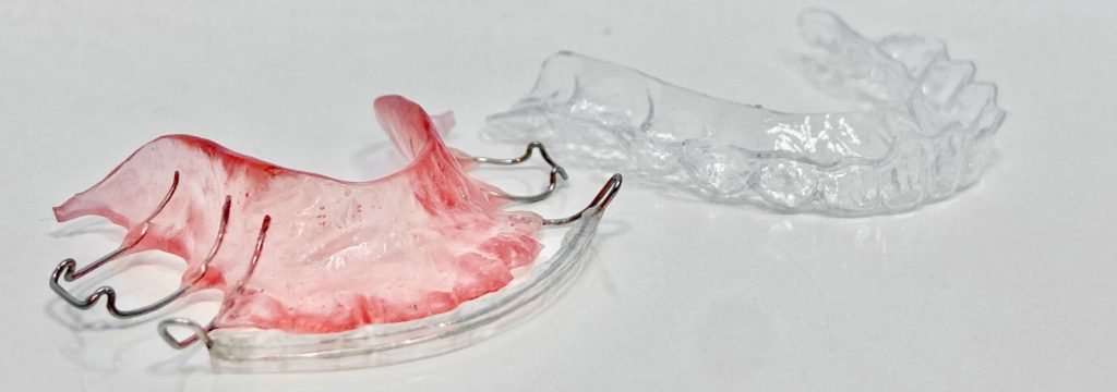 removable retainers