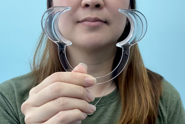 woman holding a cheek retractor
